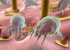 dust-allergy