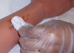 First Aid