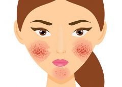 Skin-1