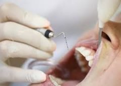 Piorrea-1