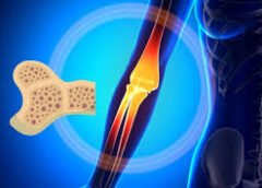 Prevent Bone Pain